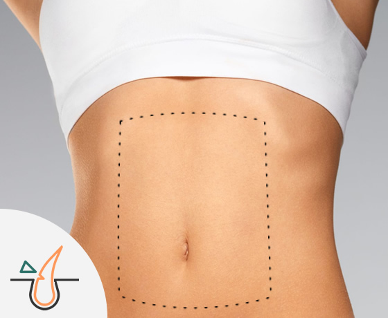 Abdomen