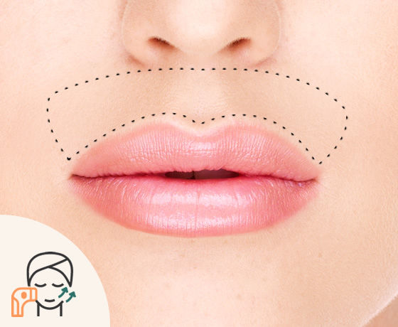 Bigote