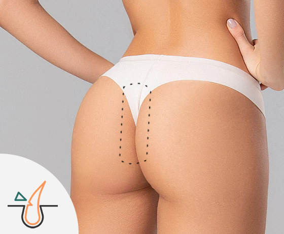 Extensión de Bikini
