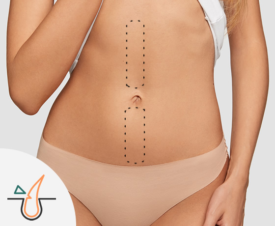 Media Línea de Abdomen