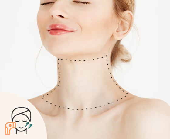 Cuello